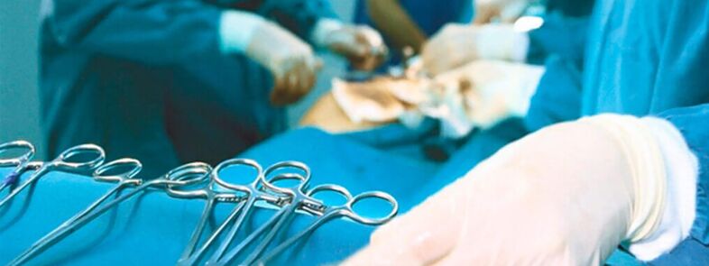 Χειρουργική επέκταση πέους που πραγματοποιήθηκε από χειρουργό